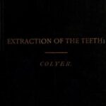 Extraction of the Teeth