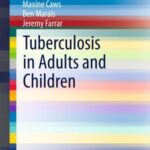 Tuberculosis in Adults and Children